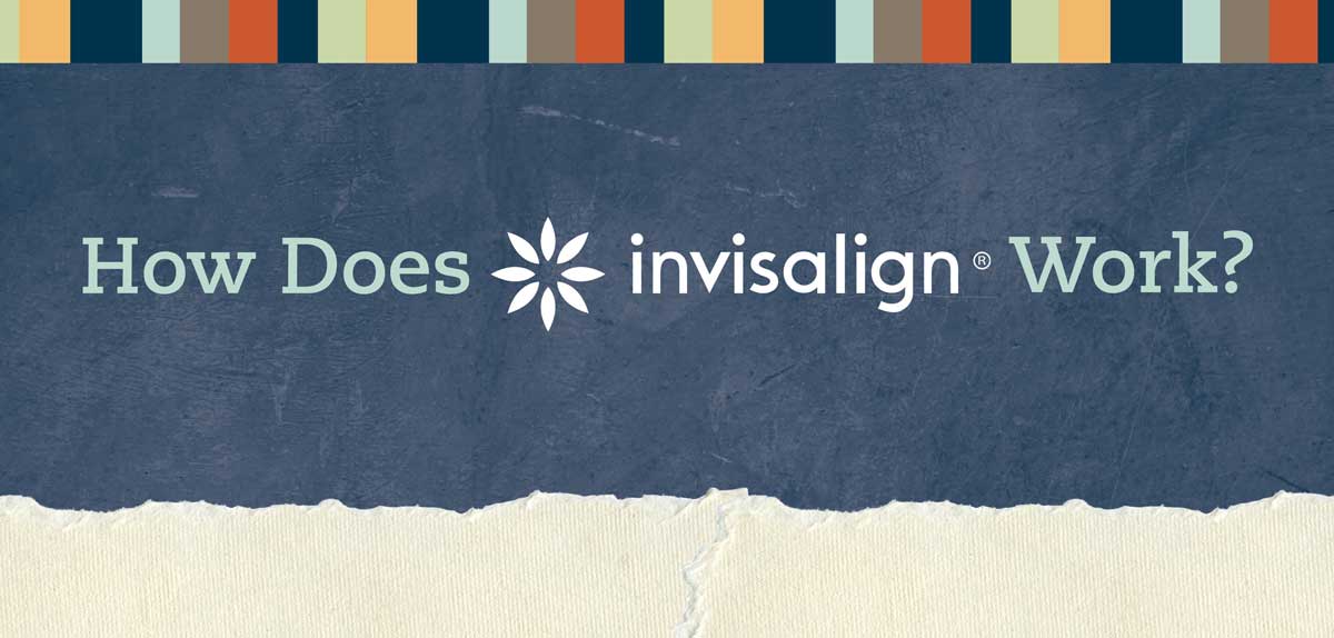invisalign