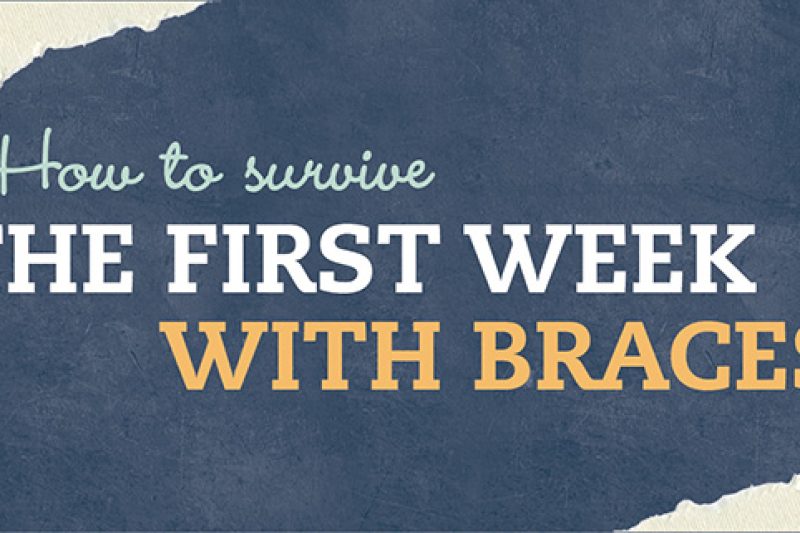 How to survive the first week in braces