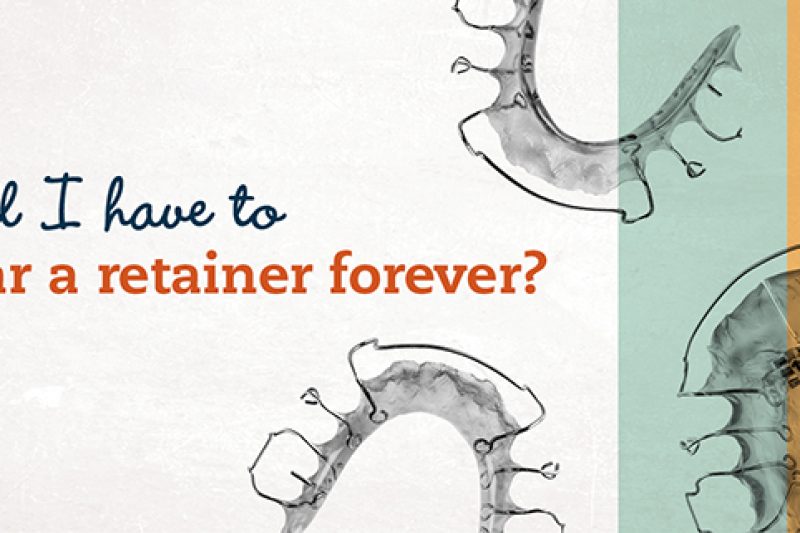Will I have to wear my retainer forever?