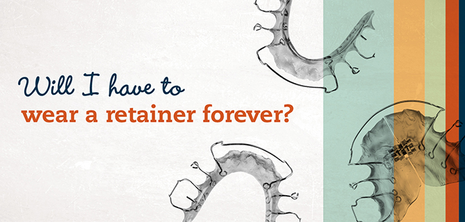 Retainers and how they keep your smile straight